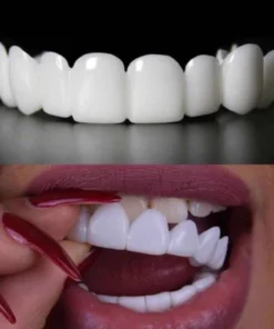 Instant Smile Reusable Snap On Veneers (Upper & Lower) Premium Quality