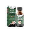 Nail Fungus Treatment Serum 10ml